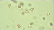 Hygrocybe mucronella, spores