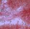 Atelier microscopie : cystides à crochets de Pluteus cervinus