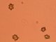 Inocybe asterospora - spores
