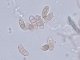Dacrymyces stillatus - Spores cloisonnées
